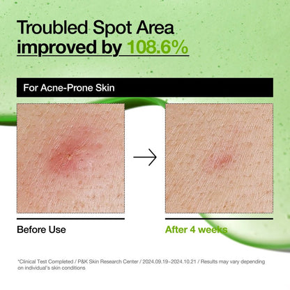 Anua Azelaic Acid 10 Hyaluron Redness Soothing Serum