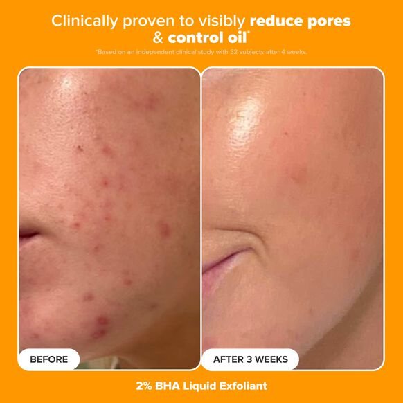 Paula's Choice
The Protect & Glow Kit