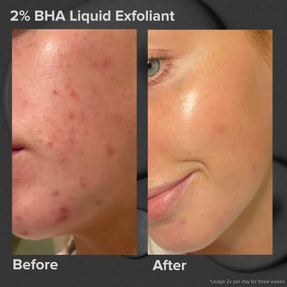 Paula's Choice Skin Perfecting2% BHA Liquid Exfoliant 30ml